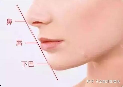 女人吃瓜下巴脱臼了,女子下巴脱臼惊心动魄